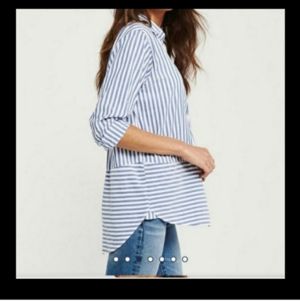 Abercrombie & Fitch Blue and White Striped Button-Up Tunic
